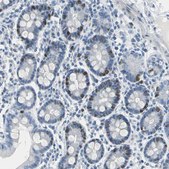 Anti-MCM3 antibody produced in rabbit Ab2, Prestige Antibodies&#174; Powered by Atlas Antibodies, affinity isolated antibody, buffered aqueous glycerol solution