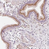 Anti-CHST4 antibody produced in rabbit Prestige Antibodies&#174; Powered by Atlas Antibodies, affinity isolated antibody, buffered aqueous glycerol solution