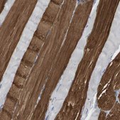 Anti-MYL3 antibody produced in rabbit Prestige Antibodies&#174; Powered by Atlas Antibodies, affinity isolated antibody, buffered aqueous glycerol solution