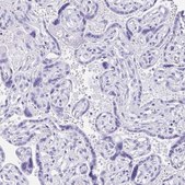Anti-IAPP antibody produced in rabbit Prestige Antibodies&#174; Powered by Atlas Antibodies, affinity isolated antibody, buffered aqueous glycerol solution