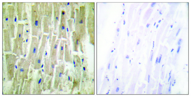 Anti-PDLIM1 antibody produced in rabbit affinity isolated antibody