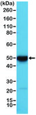 Anti-Cytokeratin 17 (CK-17) antibody, Rabbit monoclonal recombinant, expressed in HEK 293 cells, clone RM351, purified immunoglobulin