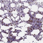 Anti-MMP9 antibody produced in rabbit affinity isolated antibody, buffered aqueous glycerol solution