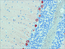 Anti-Myosin Va (LF-18) antibody produced in rabbit ~0.4&#160;mg/mL, affinity isolated antibody, buffered aqueous solution