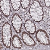 Anti-HMGA2 antibody produced in rabbit Prestige Antibodies&#174; Powered by Atlas Antibodies, affinity isolated antibody, buffered aqueous glycerol solution