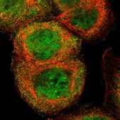 Anti-CASP8 antibody produced in rabbit Prestige Antibodies&#174; Powered by Atlas Antibodies, affinity isolated antibody, buffered aqueous glycerol solution
