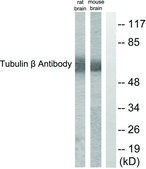 Anti-Tubulin &#946; antibody produced in rabbit affinity isolated antibody