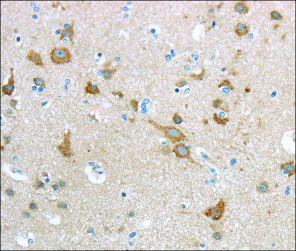 Anti-HCN4 affinity isolated antibody