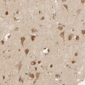 Anti-TMEM192 antibody produced in rabbit Prestige Antibodies&#174; Powered by Atlas Antibodies, affinity isolated antibody, buffered aqueous glycerol solution