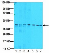 Anti-Casein Kinase 2&#945; Antibody, 1AD9 clone 1AD9, from mouse