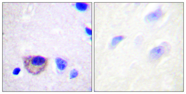 Anti-ATPASE antibody produced in rabbit affinity isolated antibody