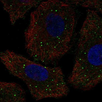 Anti-GALNT9 antibody produced in rabbit Prestige Antibodies&#174; Powered by Atlas Antibodies, affinity isolated antibody