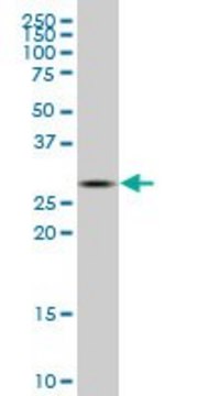 ANTI-CA1 antibody produced in mouse clone 10E4, purified immunoglobulin, buffered aqueous solution