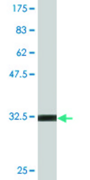 Monoclonal Anti-CHFR antibody produced in mouse clone 2B11, purified immunoglobulin, buffered aqueous solution