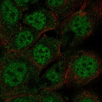 Anti-Foxp3 Antibody Produced In Rabbit Prestige Antibodies&#174; Powered by Atlas Antibodies, affinity isolated antibody, buffered aqueous glycerol solution