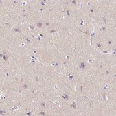 Anti-SSTR4 antibody produced in rabbit Prestige Antibodies&#174; Powered by Atlas Antibodies, affinity isolated antibody, buffered aqueous glycerol solution