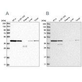 Anti-PPP1R8 antibody produced in rabbit Prestige Antibodies&#174; Powered by Atlas Antibodies, affinity isolated antibody, buffered aqueous glycerol solution, Ab2