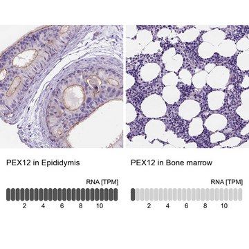 Anti-PEX12 antibody produced in rabbit Prestige Antibodies&#174; Powered by Atlas Antibodies, affinity isolated antibody, buffered aqueous glycerol solution