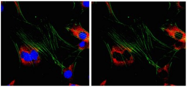 Anti-Ena/VASP-like protein Antibody from rabbit, purified by affinity chromatography