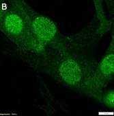 Anti-S100A4 Antibody, clone 1G2 ZooMAb&#174; Rabbit Monoclonal recombinant, expressed in HEK 293 cells