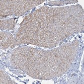 Anti-CUEDC2 antibody produced in rabbit Prestige Antibodies&#174; Powered by Atlas Antibodies, affinity isolated antibody, buffered aqueous glycerol solution