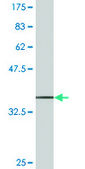 Monoclonal Anti-SCYL1, (C-terminal) antibody produced in mouse clone 2E5, purified immunoglobulin, buffered aqueous solution