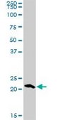 Anti-RGS5 antibody produced in rabbit purified immunoglobulin, buffered aqueous solution