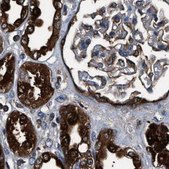 Anti-GSTP1 antibody produced in rabbit Prestige Antibodies&#174; Powered by Atlas Antibodies, affinity isolated antibody, buffered aqueous glycerol solution, Ab1