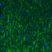 Monoclonal Anti-MBP antibody produced in mouse Prestige Antibodies&#174; Powered by Atlas Antibodies, clone CL2827, purified immunoglobulin, buffered aqueous glycerol solution