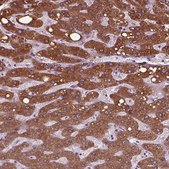 Anti-SLC27A2 antibody produced in rabbit Prestige Antibodies&#174; Powered by Atlas Antibodies, affinity isolated antibody, buffered aqueous glycerol solution