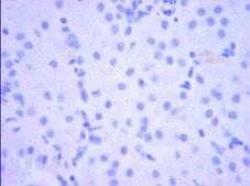 Anti-SGLT-1 (Sodium Glucose Co-transporter-1) Antibody serum, from rabbit