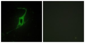 Anti-CDH20 antibody produced in rabbit affinity isolated antibody