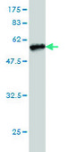 Monoclonal Anti-TREM1 antibody produced in mouse clone 2E2, purified immunoglobulin, buffered aqueous solution