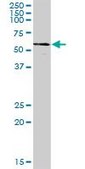 Anti-CCT8 antibody produced in mouse purified immunoglobulin, buffered aqueous solution