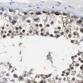 Anti-PITRM1 antibody produced in rabbit Ab2, Prestige Antibodies&#174; Powered by Atlas Antibodies, affinity isolated antibody, buffered aqueous glycerol solution