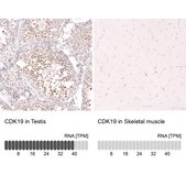 Monoclonal Anti-Cdk19 Antibody Produced In Mouse Prestige Antibodies&#174; Powered by Atlas Antibodies, clone CL14116, affinity isolated antibody, buffered aqueous glycerol solution