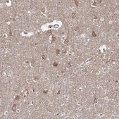 Anti-HARS antibody produced in rabbit Prestige Antibodies&#174; Powered by Atlas Antibodies, affinity isolated antibody, buffered aqueous glycerol solution