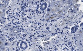 Anti-MeCP2 Antibody, clone 1L20 ZooMAb&#174; Rabbit Monoclonal recombinant, expressed in HEK 293 cells