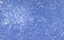 Anti-PKC&#946; Antibody, clone 2E13 ZooMAb&#174; Rabbit Monoclonal recombinant, expressed in HEK 293 cells