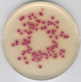 Chromocult&#174; Coliform Agar ISO 9308-1: 2014, For the simultaneous detection and enumeration of coliform bacteria and E. coli
