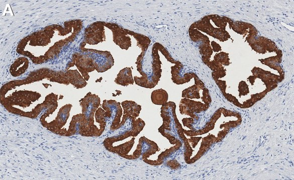 Anti-PSA Antibody, clone 1E10 ZooMAb&#174; Rabbit Monoclonal recombinant, expressed in HEK 293 cells