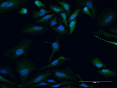 Anti-PBK antibody produced in mouse purified immunoglobulin, buffered aqueous solution