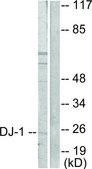 Anti-DJ-1 antibody produced in rabbit affinity isolated antibody