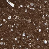 Anti-SV2A antibody produced in rabbit Prestige Antibodies&#174; Powered by Atlas Antibodies, affinity isolated antibody, buffered aqueous glycerol solution