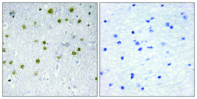 Anti-NRIP2 antibody produced in rabbit affinity isolated antibody
