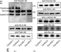 Anti-Vinculin Antibody, clone V284 clone V284, Upstate&#174;, from mouse