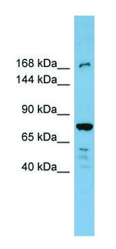 Anti-DAPK1 (N-terminal) antibody produced in rabbit affinity isolated antibody