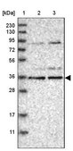 Anti-KLHDC3 antibody produced in rabbit Prestige Antibodies&#174; Powered by Atlas Antibodies, affinity isolated antibody, buffered aqueous glycerol solution, ab1