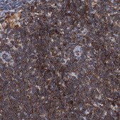 Anti-LCP2 antibody produced in rabbit Prestige Antibodies&#174; Powered by Atlas Antibodies, affinity isolated antibody, buffered aqueous glycerol solution