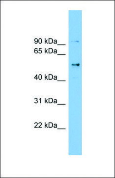 Anti-CCDC50 antibody produced in rabbit affinity isolated antibody